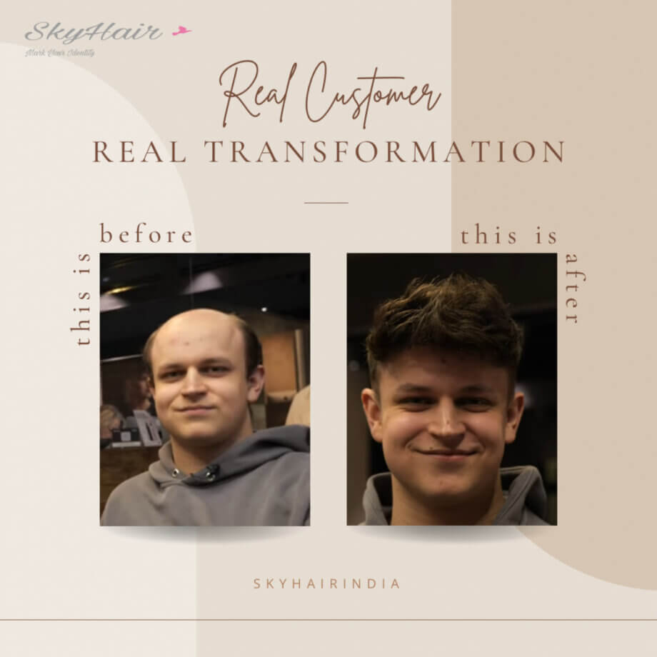 Fine R Mono Hair Patch
