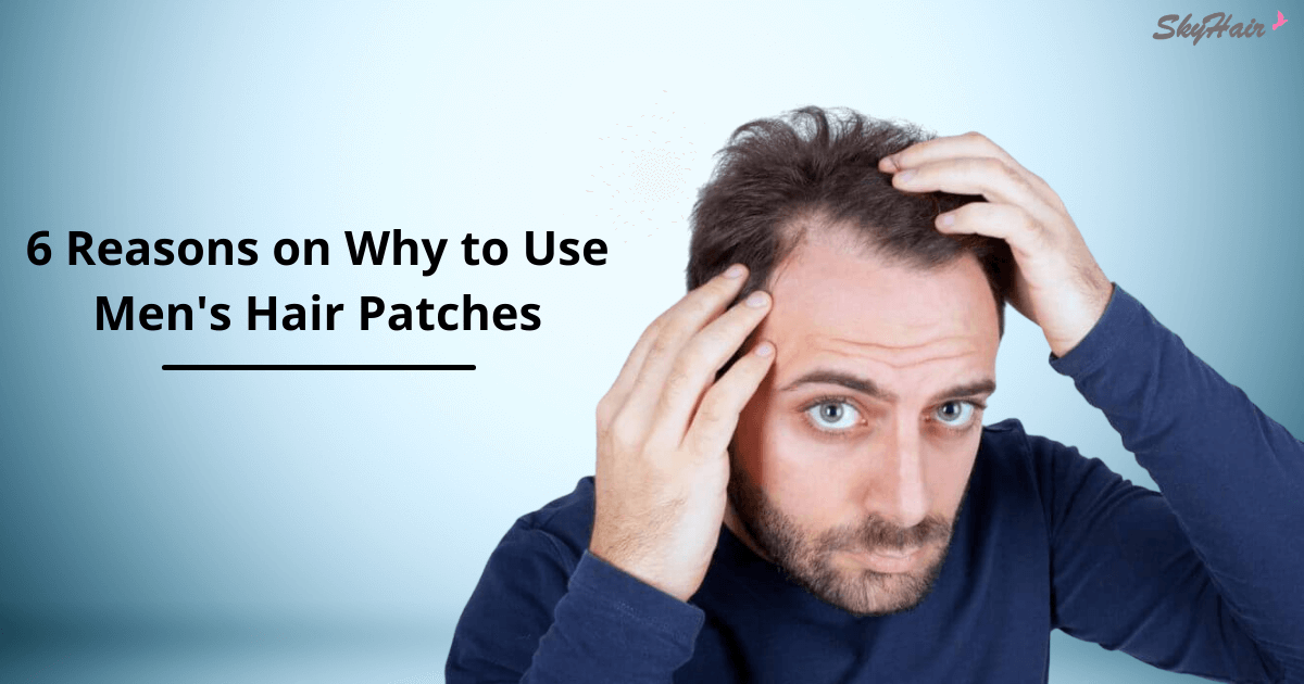 Reasons Why to Use Men's Hair Patches