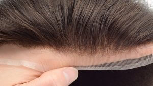 Types of Hair Patches for Men in India - SkyHair